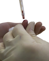 live-blood-testing